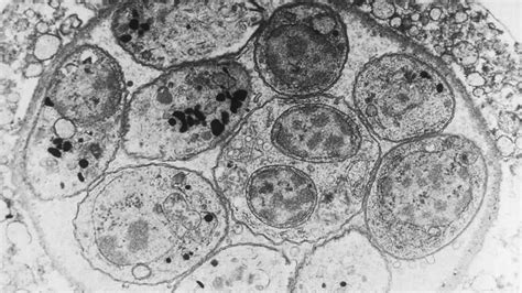  Taxoplasma gondii: ¡Un parásito escurridizo que controla las mentes de sus huéspedes!